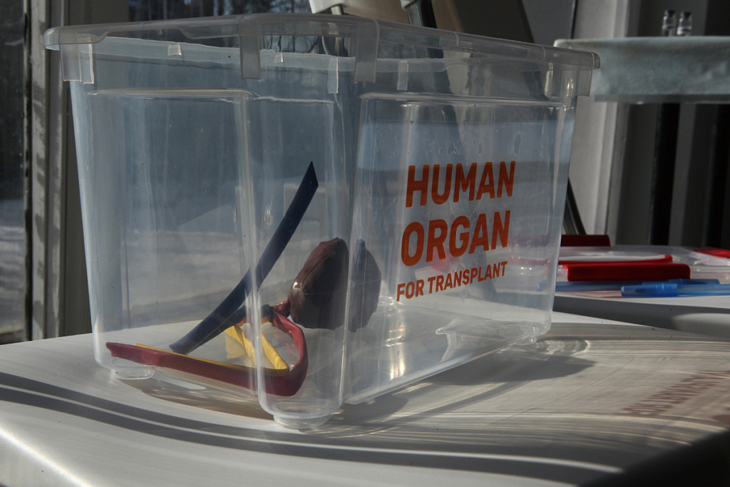 ТРАНСПЛАНТОЛОГИЯ. Изображение 2